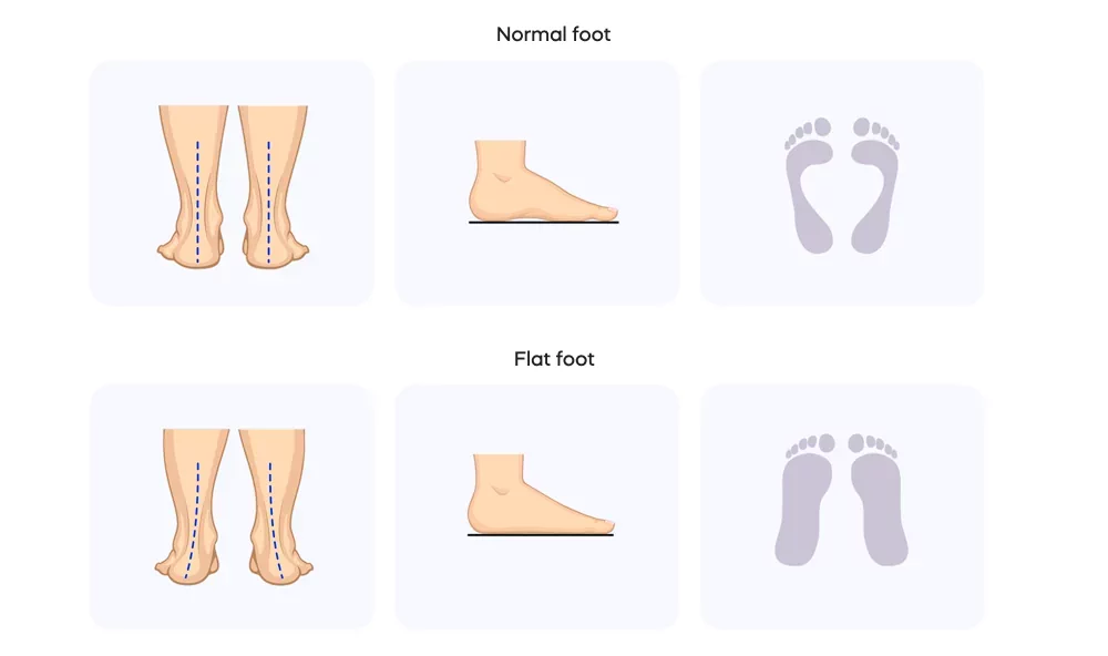 According to the degree of severity, they are distinguished: